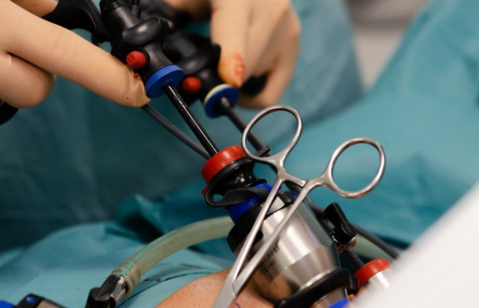 Operacja laparoskopowa