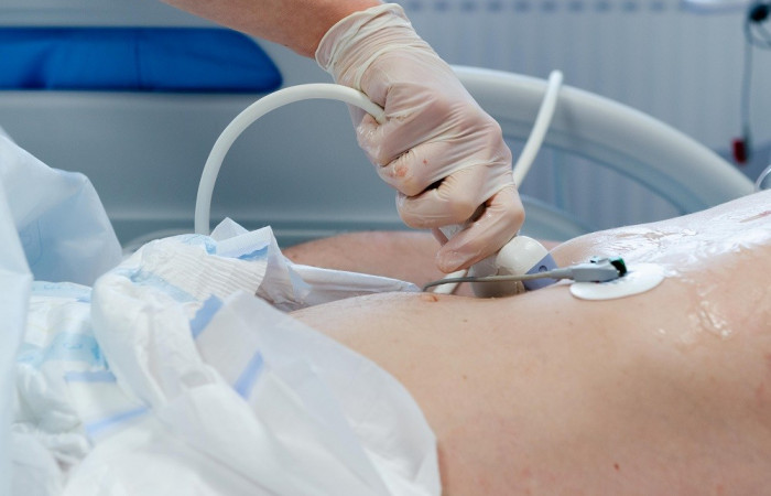 Lekarz wykonuje USG pacjenta, zbliżenie