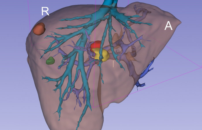 Pracownia Funkcjonalnego i Wirtualnego Medycznego Obrazowania 3D