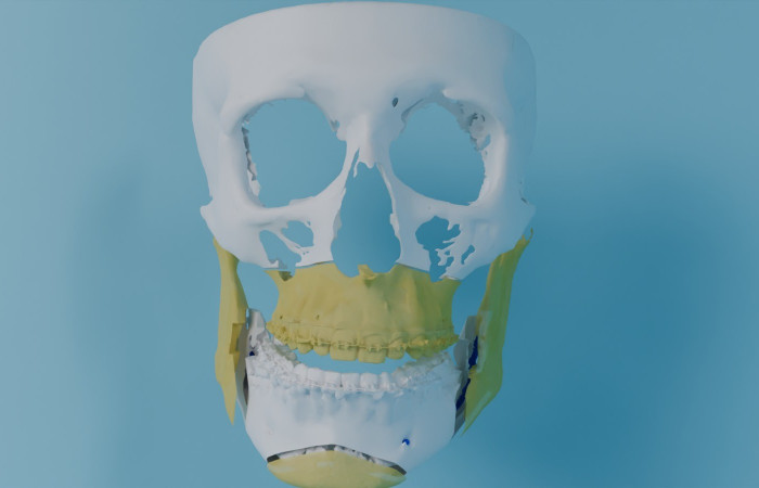 Pracownia Funkcjonalnego i Wirtualnego Medycznego Obrazowania 3D
